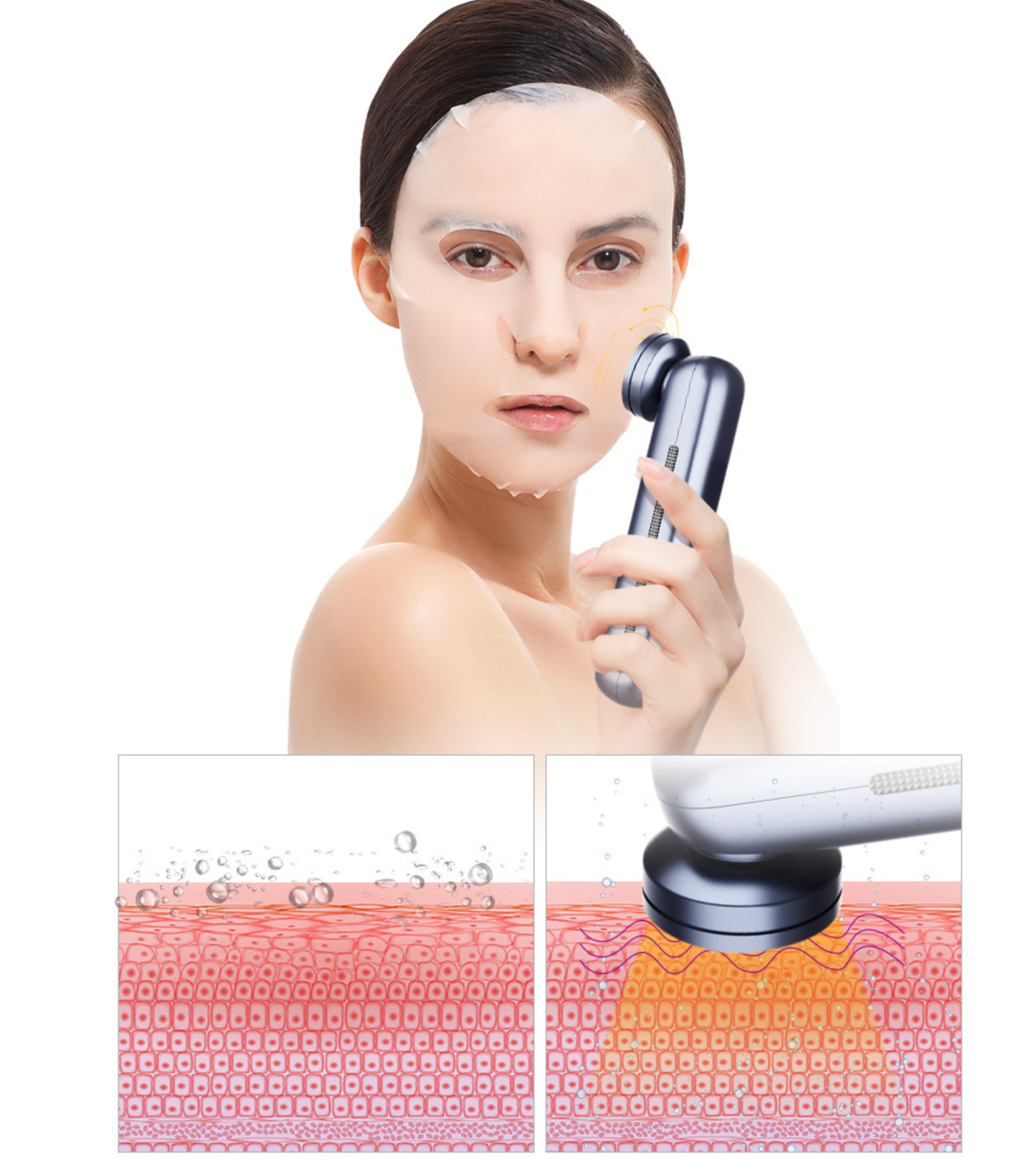 M99 ультразвуковой прибор для лица с функцией охлаждения: омоложение и уход на профессиональном уровне - Image 4